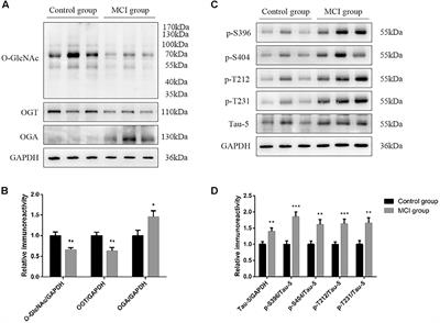 Increased Ratio of Global O-GlcNAcylation to Tau Phosphorylation at Thr212 Site Is Associated With Better Memory Function in Patients With Type 2 Diabetes